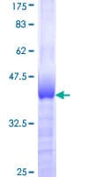 Human ZNF207 Protein (Recombinant GST, N-terminus)