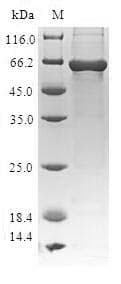 Human TARBP2 / TRBP2 Protein (Recombinant GST, N-terminus)