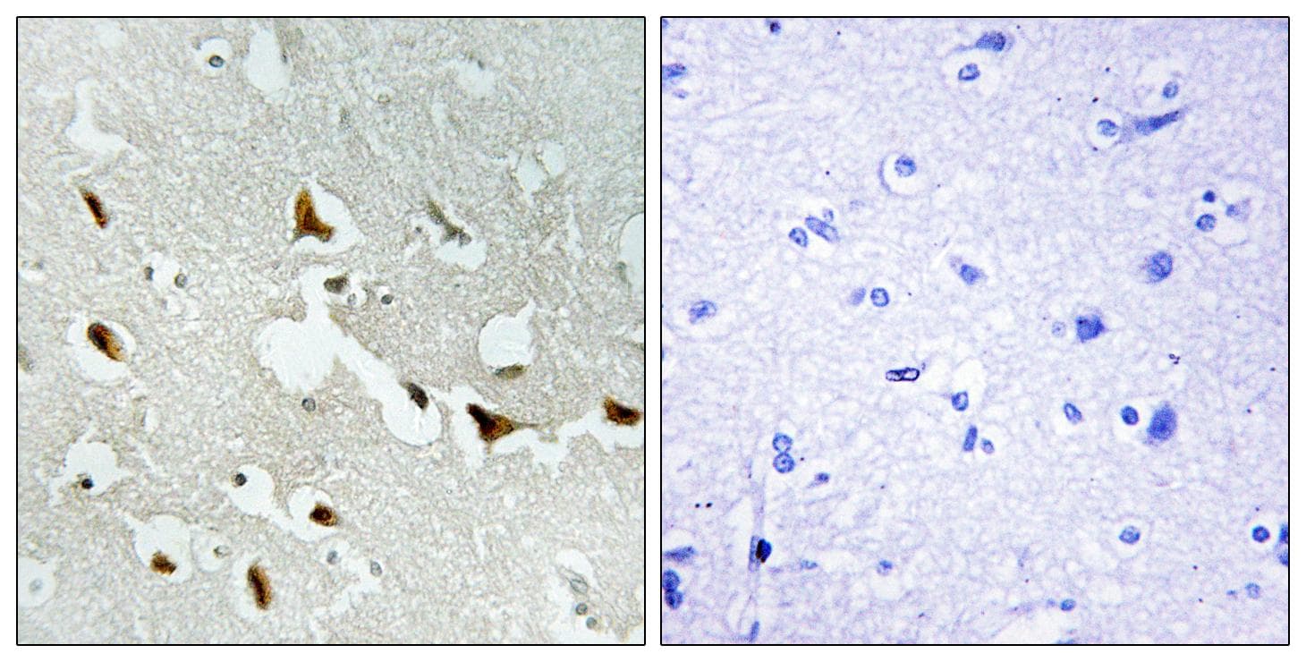 IRS1 Antibody (p636)