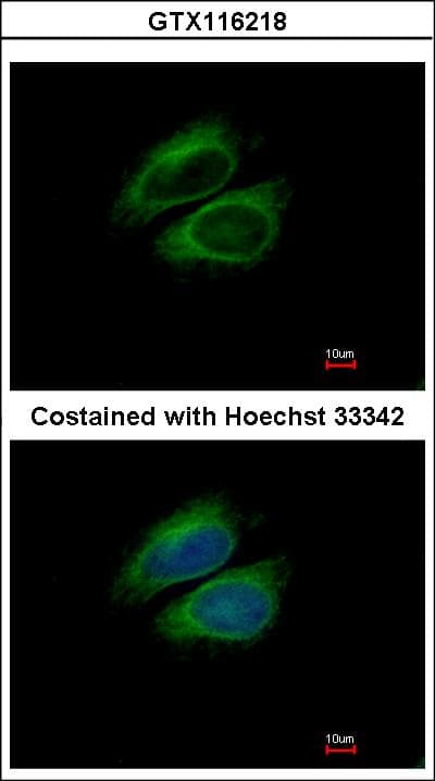 CSDE1 Antibody (aa198-433)