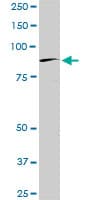 BRD2 / RING3 Antibody (clone 3D10)