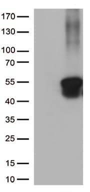 KRT8 / CK8 / Cytokeratin 8 Antibody (aa91-381, clone UMAB1)