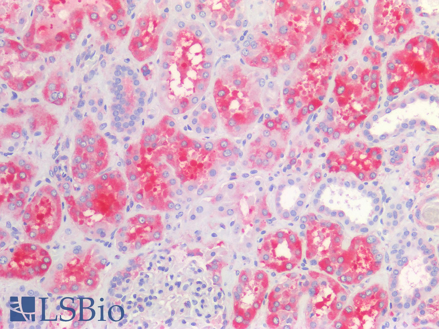 PathPlus™ MVP / VAULT1 Antibody (clone 2H3-1A6)