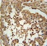 C3orf58 Antibody (aa159-188)