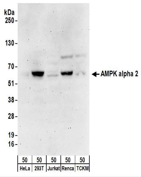 PRKAA2 / AMPK Alpha 2 Antibody (aa350-400)