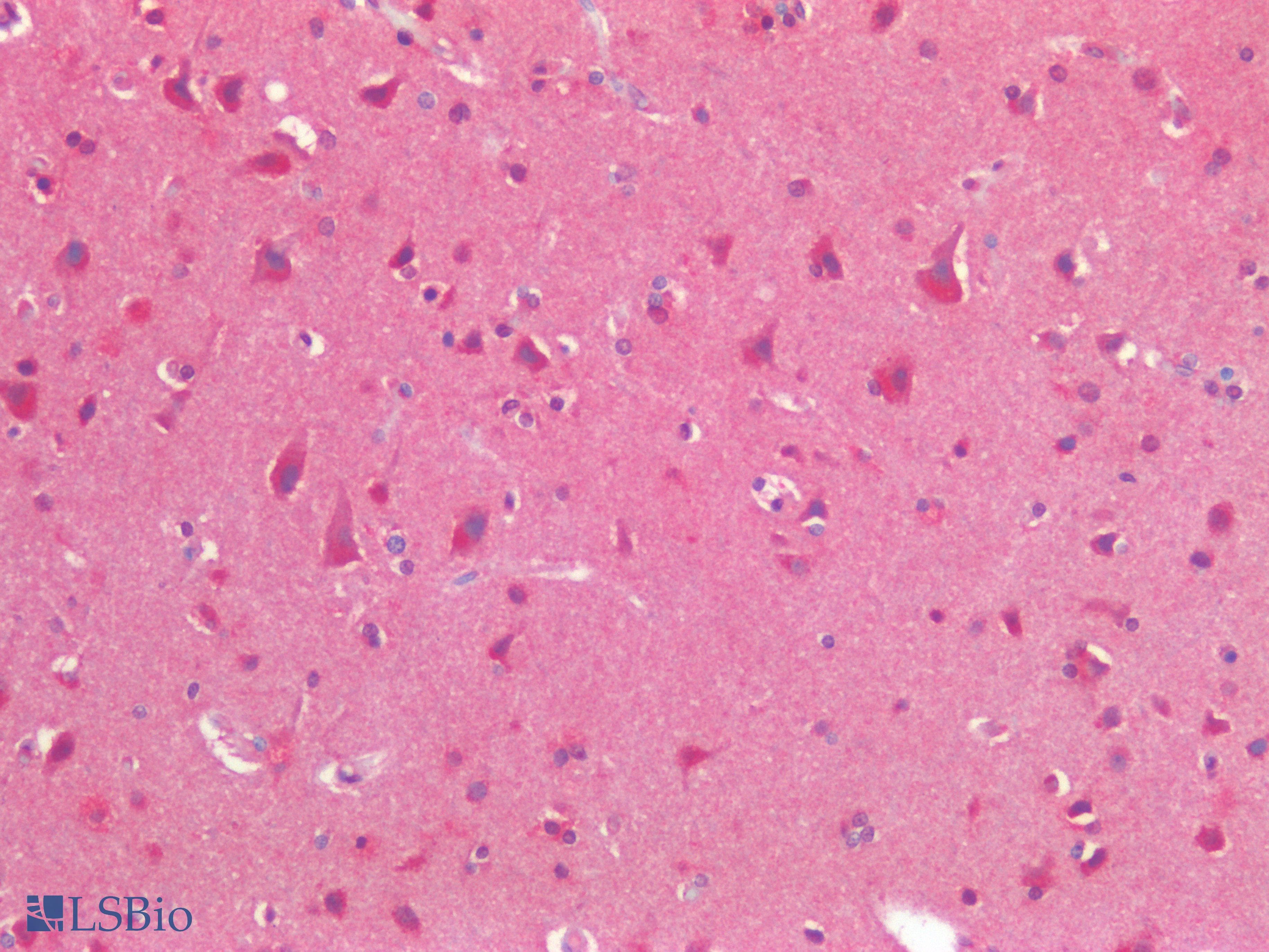 PathPlus™ Polyclonal Rabbit anti-Human Osteocalcin Antibody (IHC)