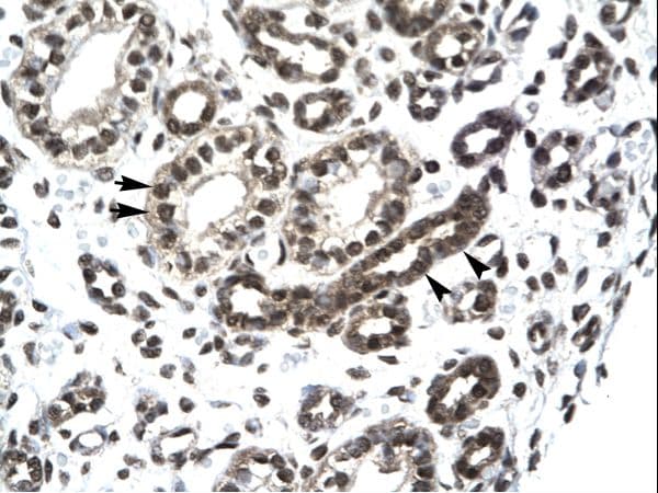 PTHLH / PTHRP Antibody (C-Terminus)