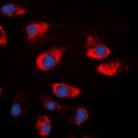 Polyclonal Rabbit anti-Human CSTA / Cystatin A Antibody (Internal, IHC, IF, WB)