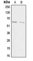 SP32 / ACRBP Antibody (Internal)