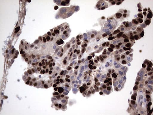 MKI67 / Ki67 Antibody (aa1160-1493, clone OTI1D9)