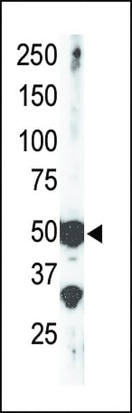 SETD7 / SET7 Antibody (aa159-189)
