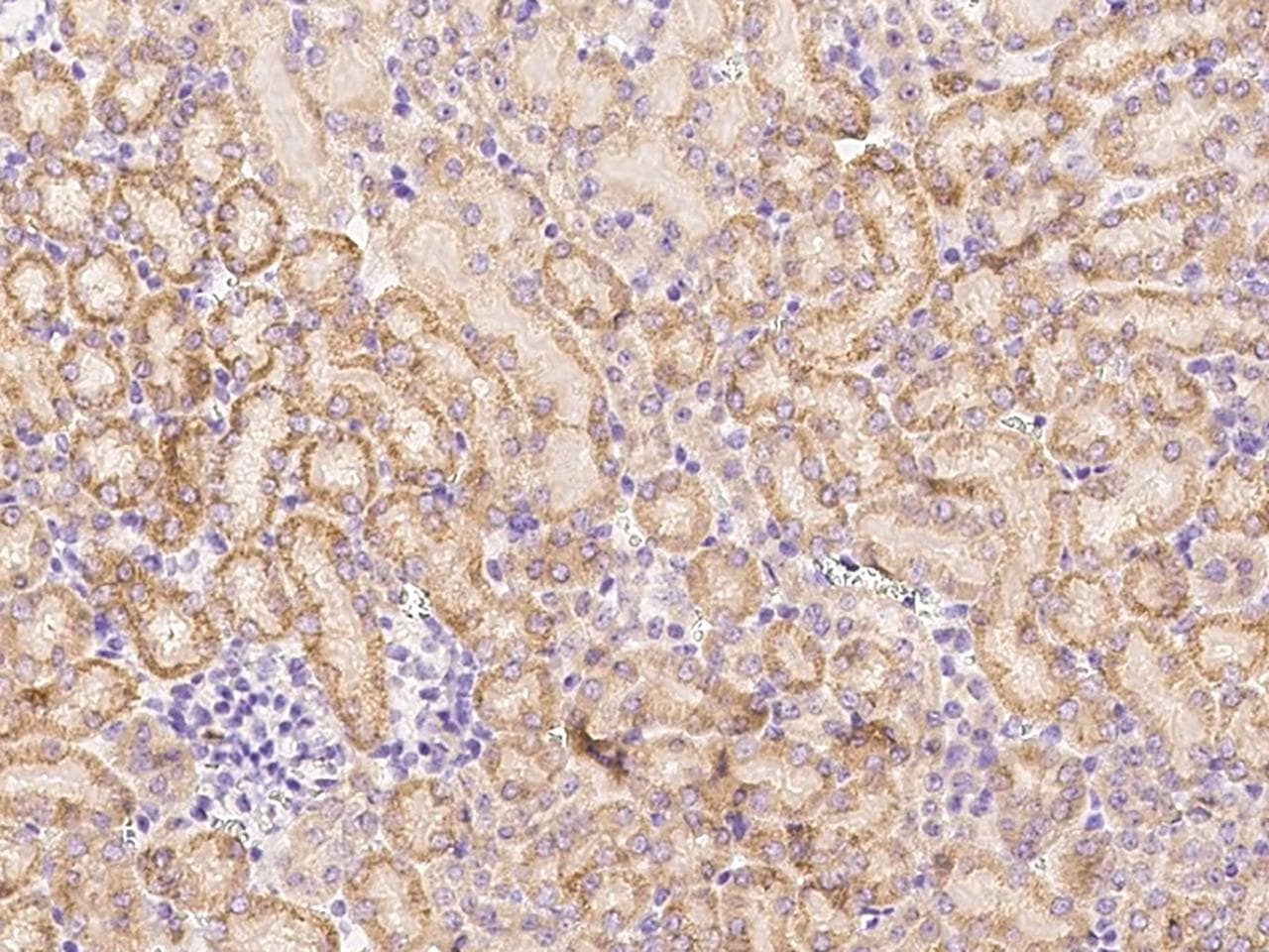 AKT2 Antibody (Preservative Free)