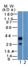 Polyclonal Rabbit anti-Human TP63 / p63 Antibody (aa5-17, IHC, WB)