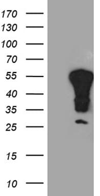 Monoclonal Mouse anti-Human MSY2 / YBX2 Antibody (clone OTI2D8, Carrier-free, IHC, WB)