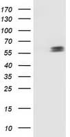 TP53 / p53 Antibody (clone OTI2F7)