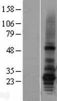 Human AGPAT2 Protein (Over-Expression Lysate Myc-DDK (Flag))
