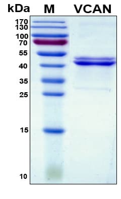 Human VCAN / Versican Protein (Recombinant His, N-Terminal)