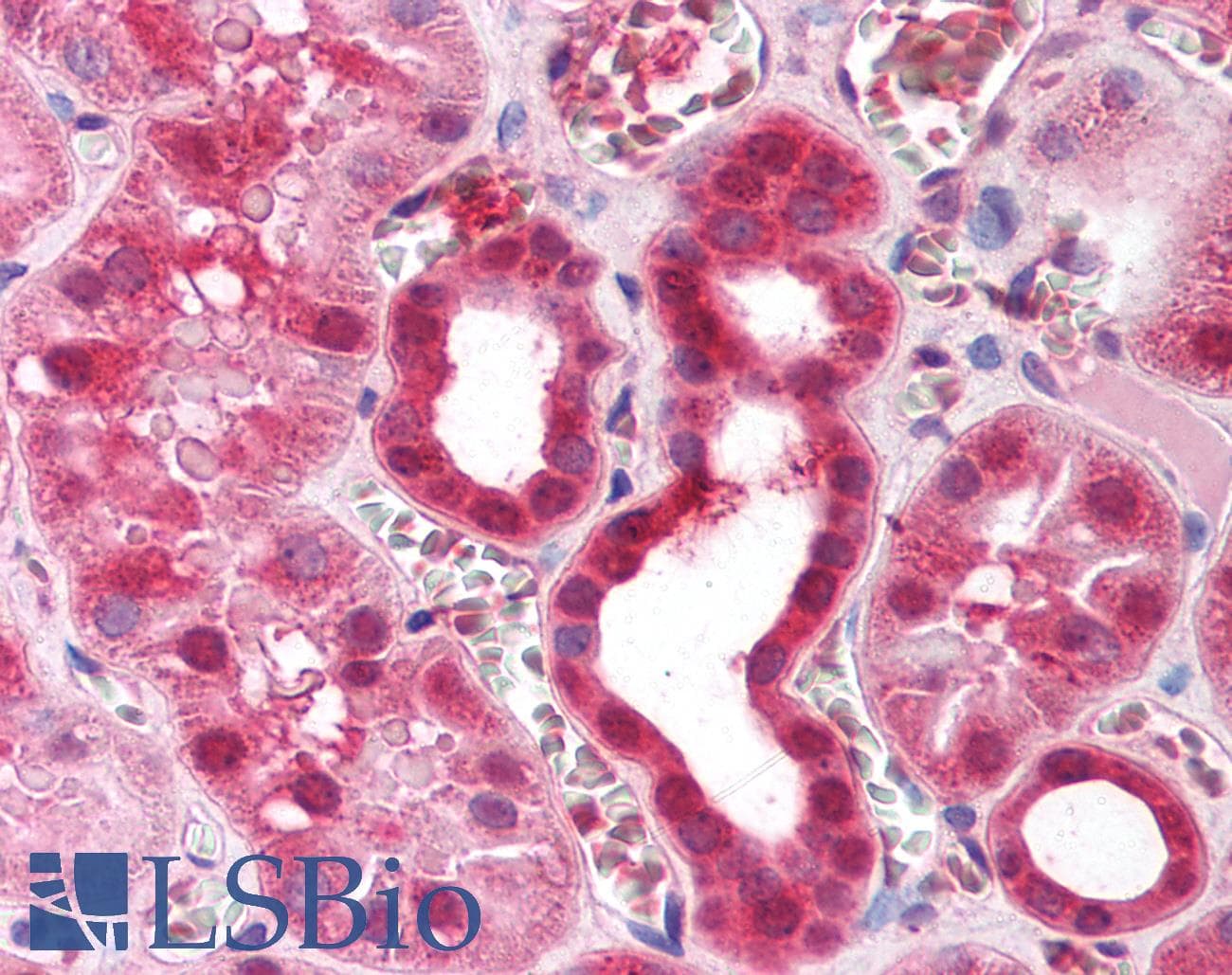 Polyclonal Rabbit anti-Human ZFP36 / Tristetraprolin Antibody (aa84-133, IHC, WB)