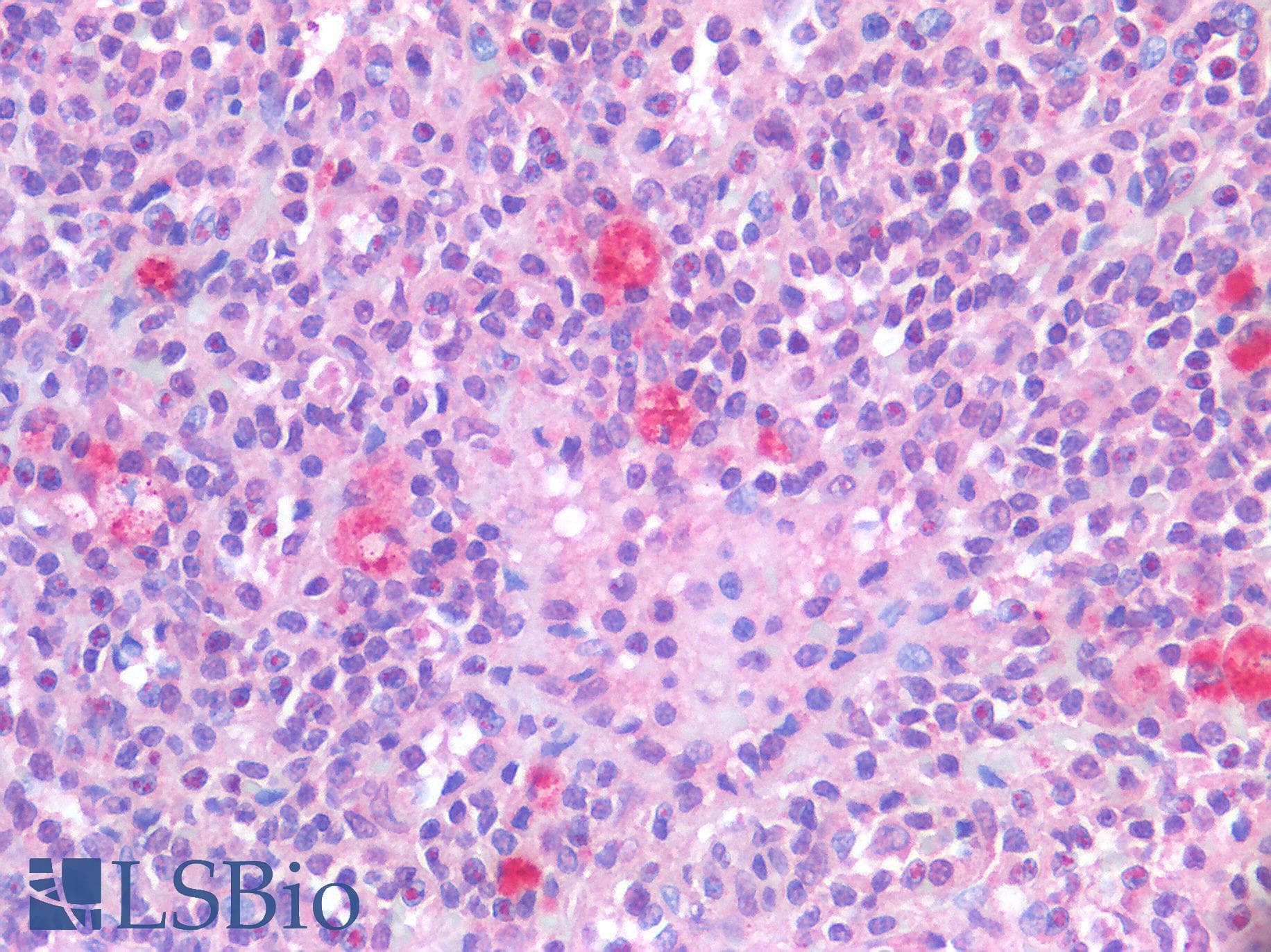 IHC-plus™ p14ARF / CDKN2A Antibody