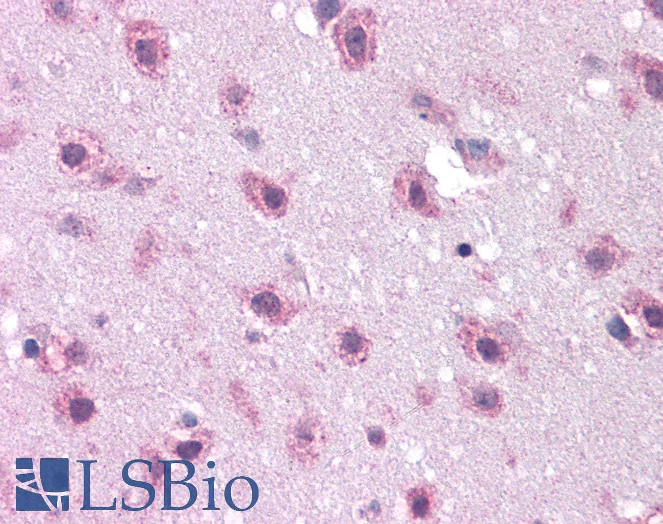 IHC-plus™ DCLK2 / DCAMKL2 Antibody