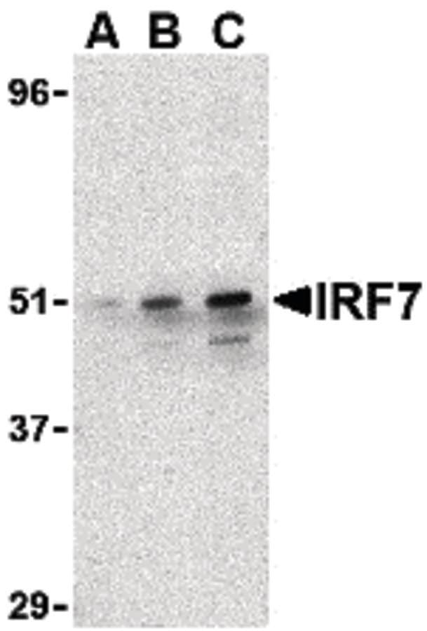 IHC-plus™ Polyclonal Rabbit anti-Human IRF7 Antibody (IHC, IF, WB)
