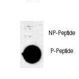 Polyclonal Rabbit anti-Human AKT1 Antibody (phospho-Thr308, IF)