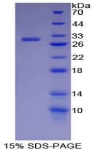 Mouse IKBIP Protein (Recombinant His-T7)