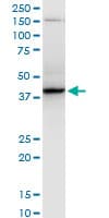Monoclonal Mouse anti-Human RNF2 / RING2 / RING1B Antibody (clone 4A9, WB)