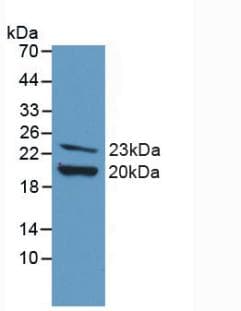FGF2 / Basic FGF Antibody (aa10-154)