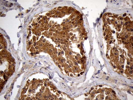 PYGM Antibody (aa698-842, clone OTI5D1, Carrier-free)