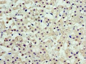 Polyclonal Rabbit anti-Human ARFGAP3 Antibody (aa217-516, IHC, WB)