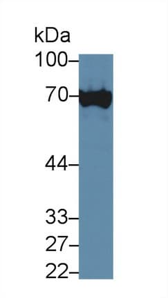 XRCC6 / Ku70 Antibody (aa397-603)