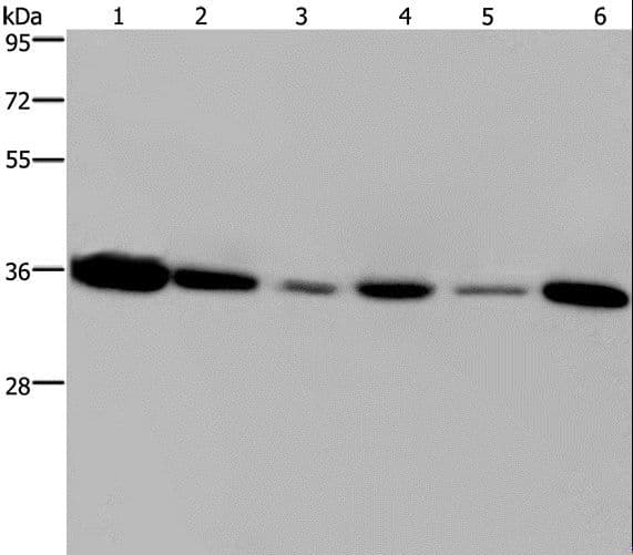 Polyclonal Rabbit anti-Human EMD / Emerin Antibody (WB)