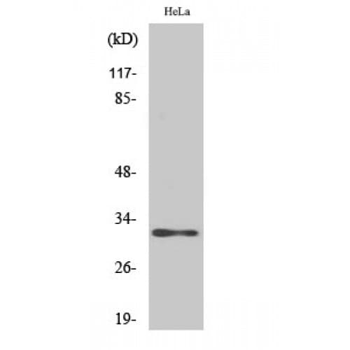 AIG1 Antibody (170-250 aa, C-terminal)