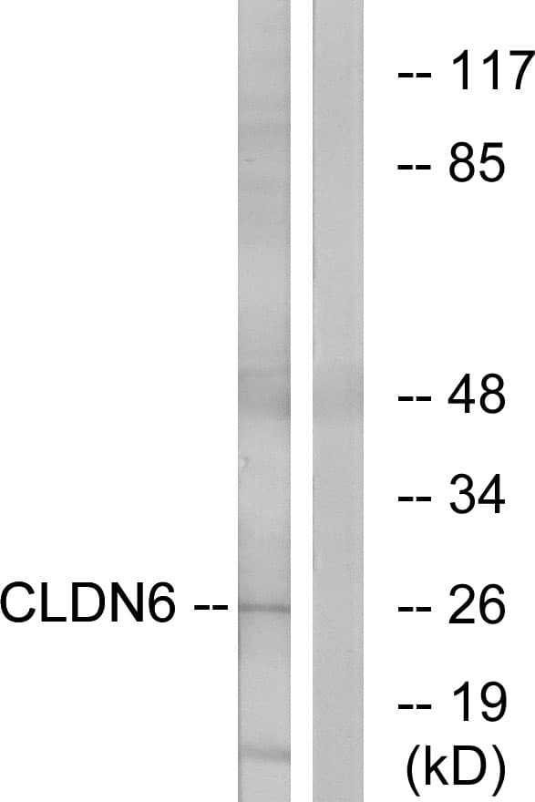 CLDN6 / Claudin 6 Antibody (aa81-130)