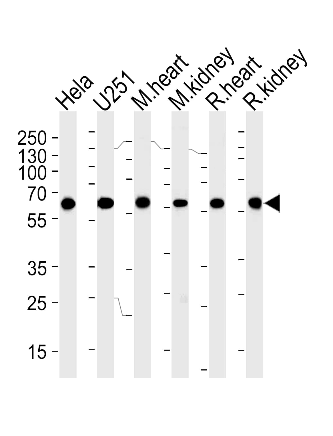 BBS4 Antibody (aa1-240, clone 1292CT845.130.218)