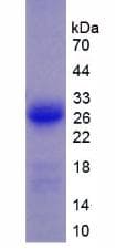 Mouse VCL / Vinculin Protein (Recombinant His, N-Terminal)