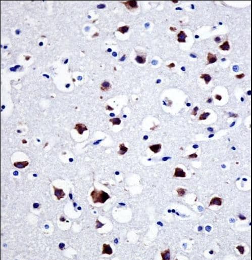 SRC Antibody (aa24-52)