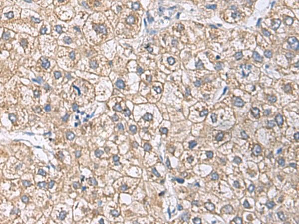UBE2N / UBC13 Antibody