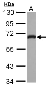 Polyclonal Rabbit anti-Human ARHGEF25 / GEFT Antibody (IHC, WB)
