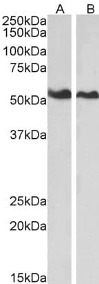 IHC-plus™ ANXA11 / Annexin XI Antibody (aa8-20)
