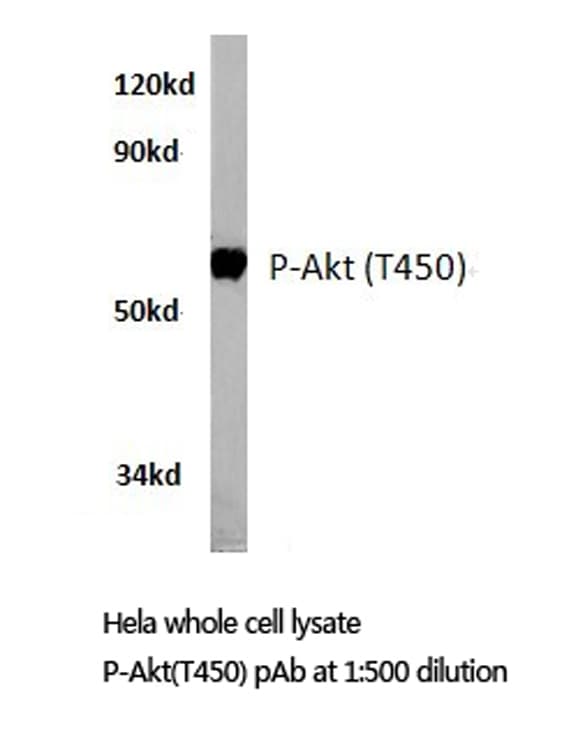 Polyclonal Rabbit anti-Human AKT1 + AKT2 + AKT3 Antibody (phospho-Thr450, IHC, WB)
