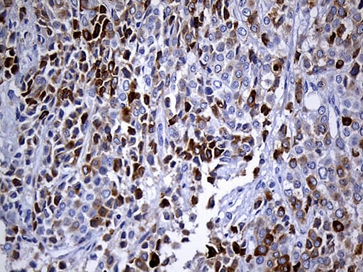 TFF3 / Trefoil Factor 3 Antibody (aa72-130, clone OTI5B2, Carrier-free)