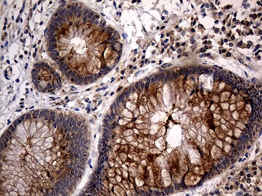 TANK Antibody (clone OTI1G2)