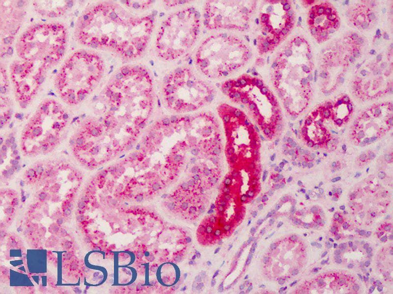 PathPlus™ SPP1 / Osteopontin Antibody