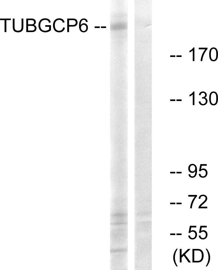 TUBGCP6 / GCP6 Antibody