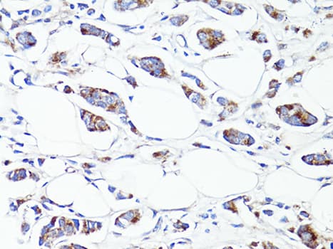 Polyclonal Rabbit anti-Human S100A10 Antibody (IHC, WB)