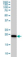SRI / Sorcin Antibody (clone 1E12)