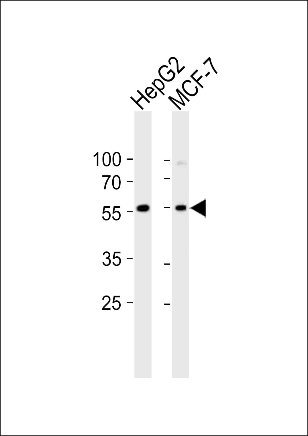 Polyclonal Rabbit anti-Human CYP2W1 Antibody (aa7-33, IHC, WB)