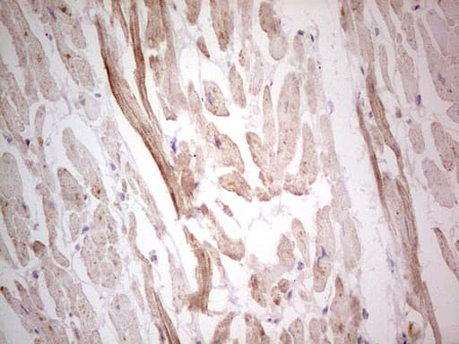 NEFM / NF-M Antibody (aa413-773, clone OTI5B7, Carrier-free)